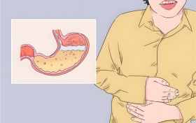 益生菌真能调肠胃？科学吃对方法，口气重问题悄悄改善